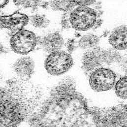 Serious Coronavirus-linked Condition Hit 285 Us Children